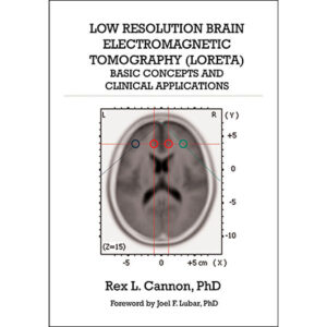 Cover of Low Resolution Brain Electromagnetic Tomography (LORETA): Basic Concepts and Clinical Applications